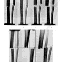 147